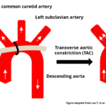 Transverse Aortic Constriction (TAC): Why, how and the outcome as it relates to pressure overload-induced cardiac hypertrophy and/or heart failure