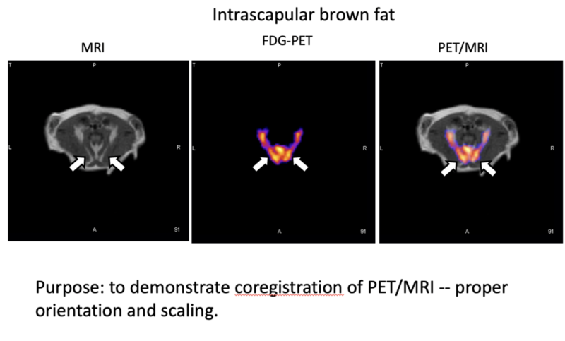 PETMRI Brown fat - Scintica