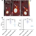 New Journal Article – Cell Proliferation Detected Using [18F]FLT PET/CT as an Early Marker of Abdominal Aortic Aaneurysm