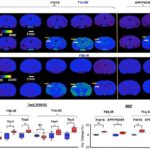 Article Review: A Surrogate Marker for Very Early-Stage Tau Pathology is Detectable by Molecular Magnetic Resonance Imaging